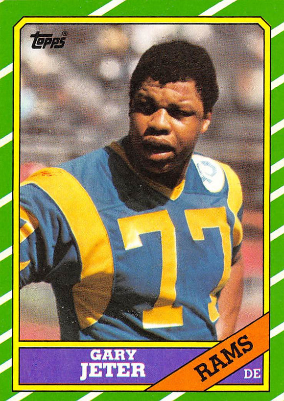 AI878 1986 TOPPS